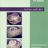 Withof... Before and after