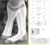 Knitting lace, susanna e lewis - immagine 2