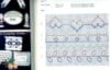 Swedish weaving iii - immagine 3